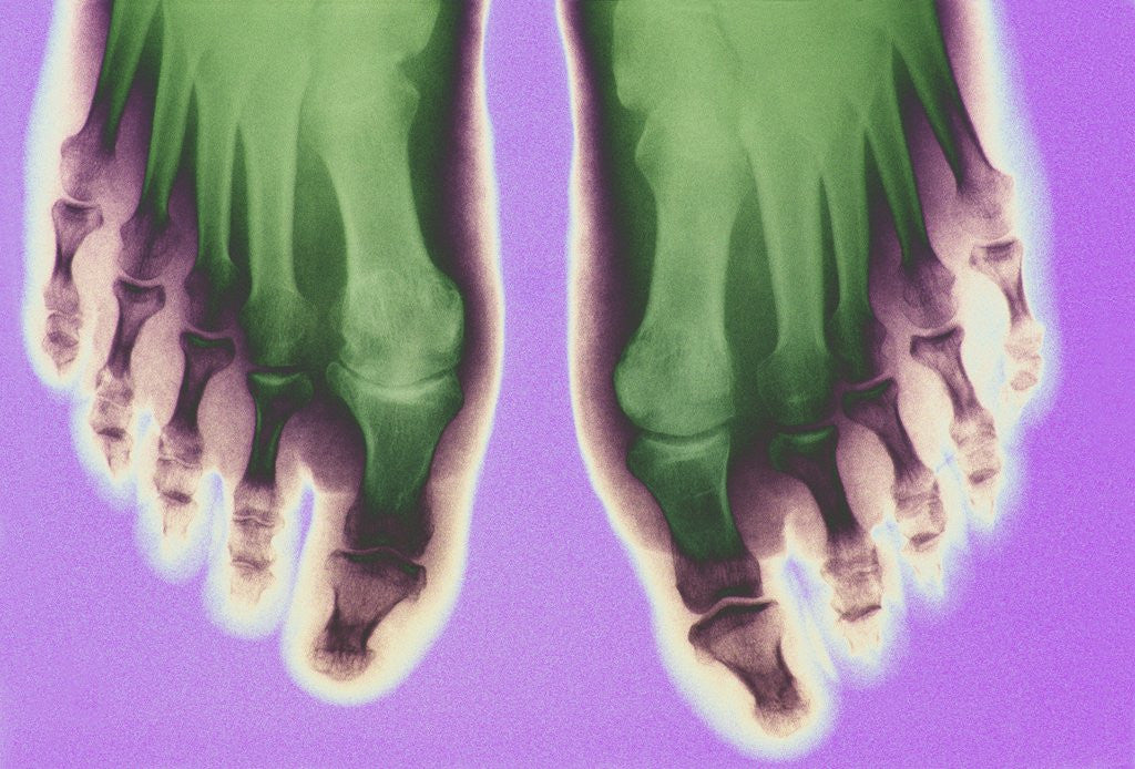 Detail of X-ray of Feet by Anonymous