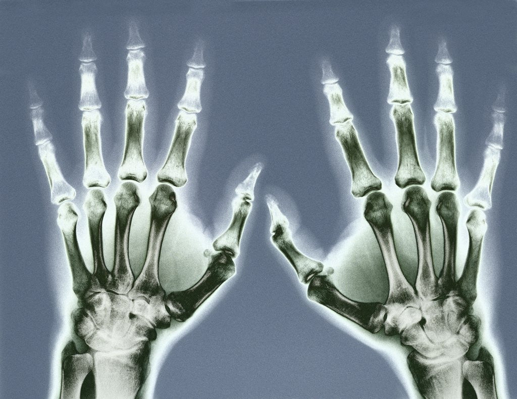 Detail of X-ray of Hands by Corbis