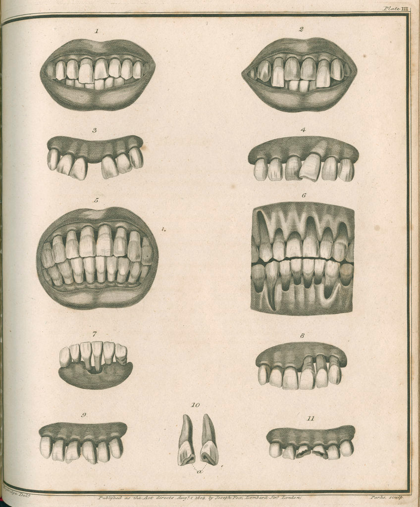 Detail of Irregularities of the teeth by Parks