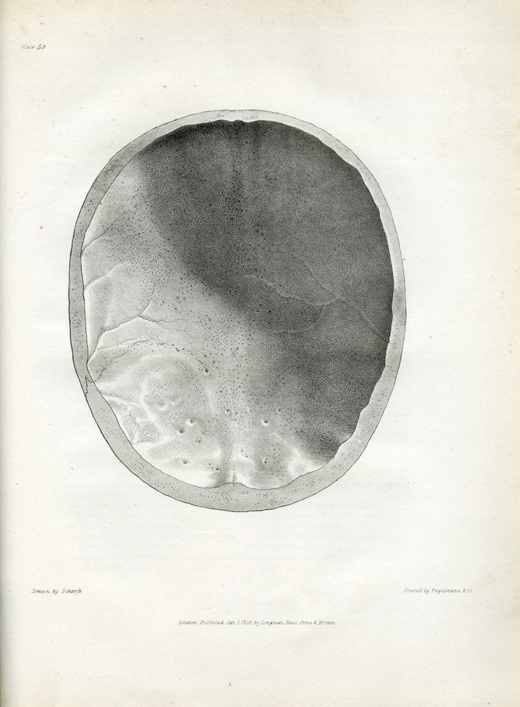 Detail of 'Epilepsy' by Godefroy Engelmann