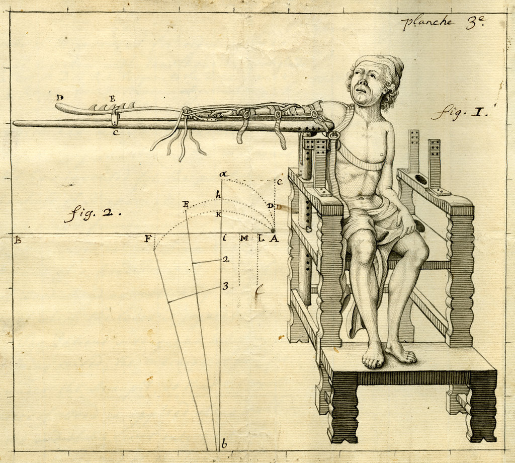 Detail of 'Ambe of Hippocrates': contraption for repairing dislocated shoulders by Claude-Nicholas Le Cat