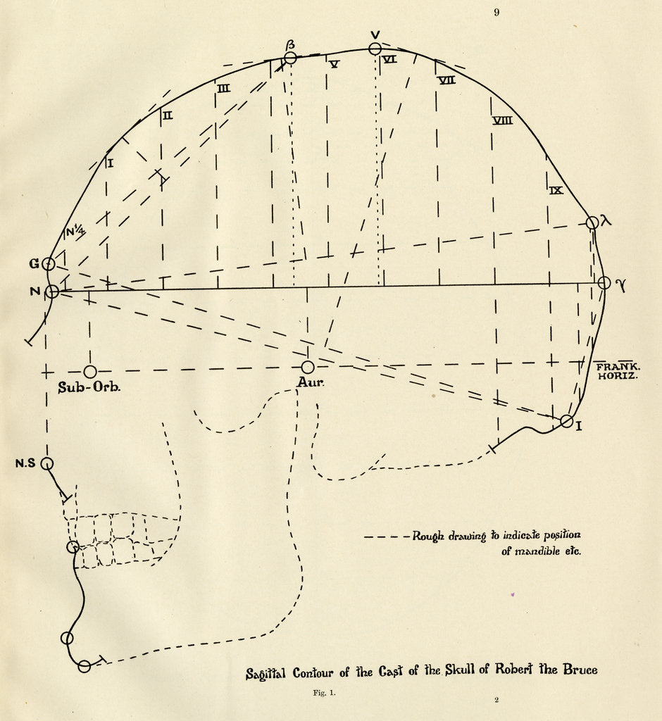 Detail of Measurements of Robert the Bruce’s skull by Unknown