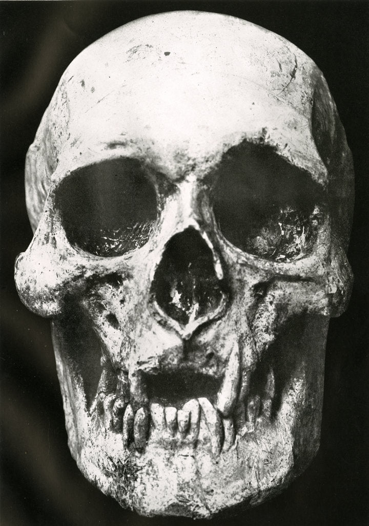 Detail of Robert the Bruce’s skull by Unknown
