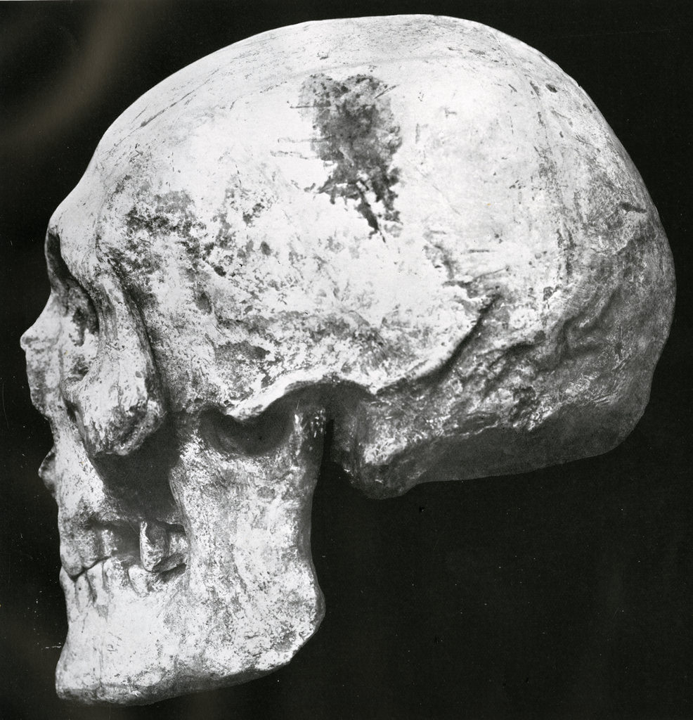Detail of Robert the Bruce’s skull by Unknown
