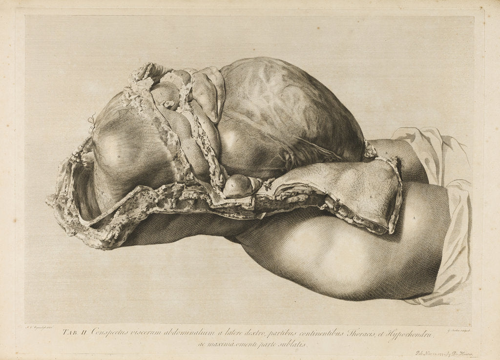 Detail of Human gravid uterus by II Scotin