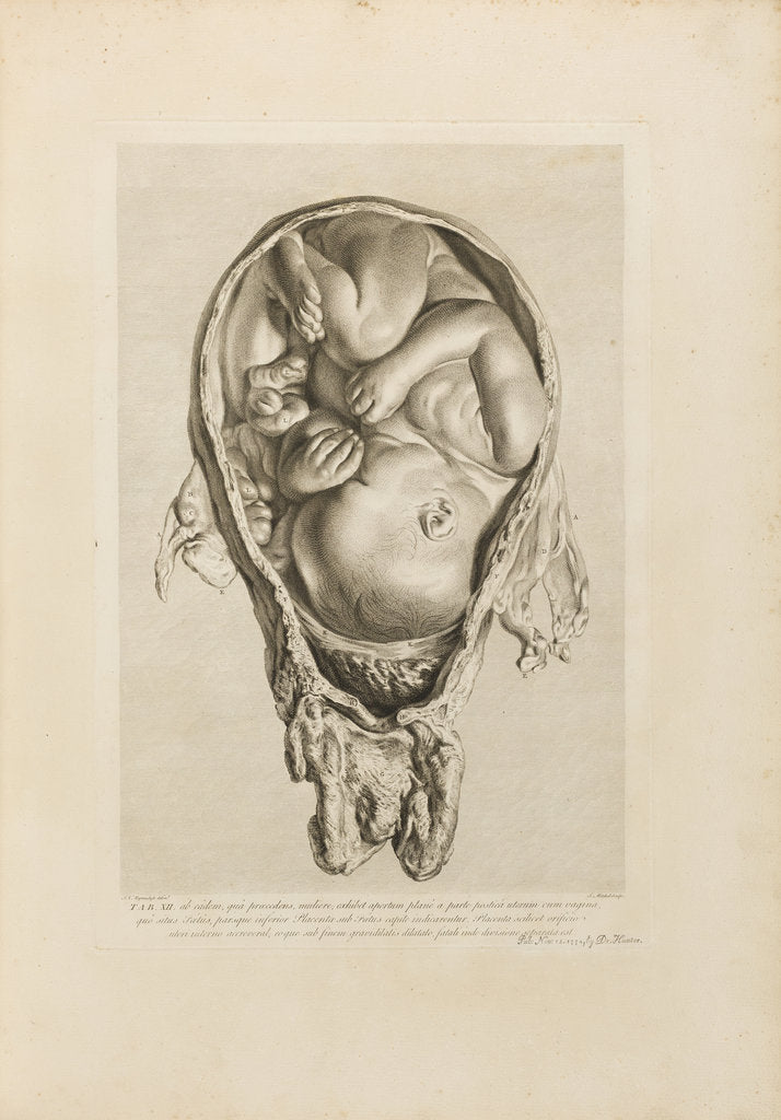 Detail of Foetus in the womb by Jean-Baptiste Michel