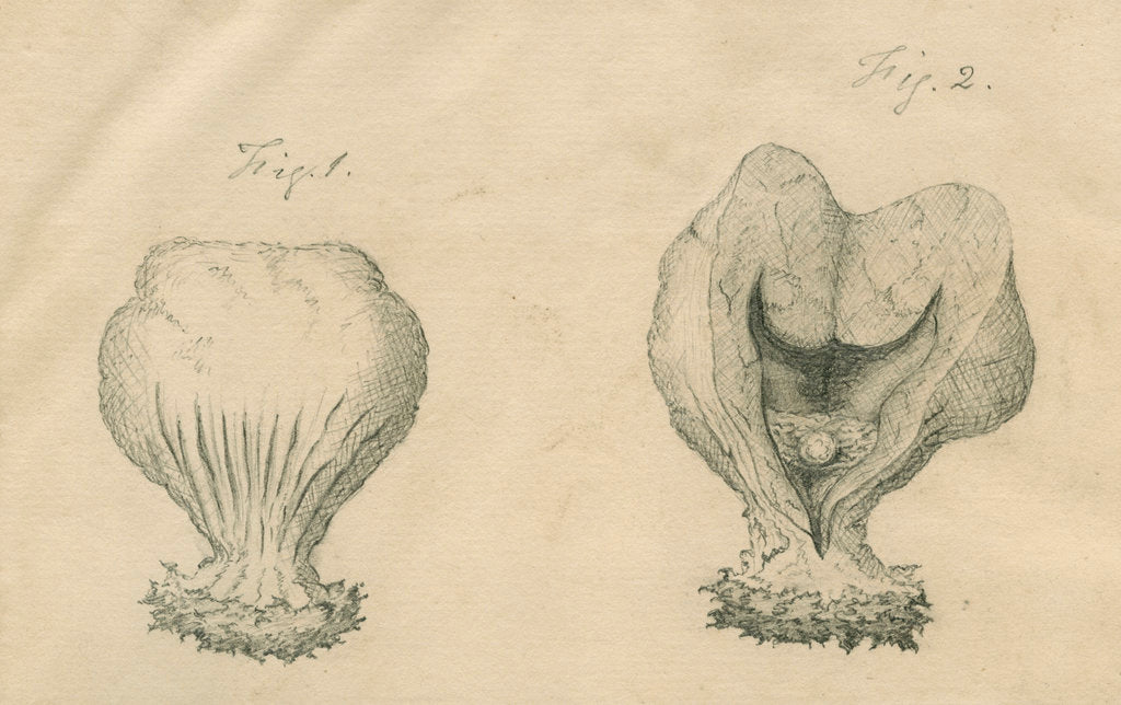 Detail of Surgically removed tumour by Caleb Burrell Rose