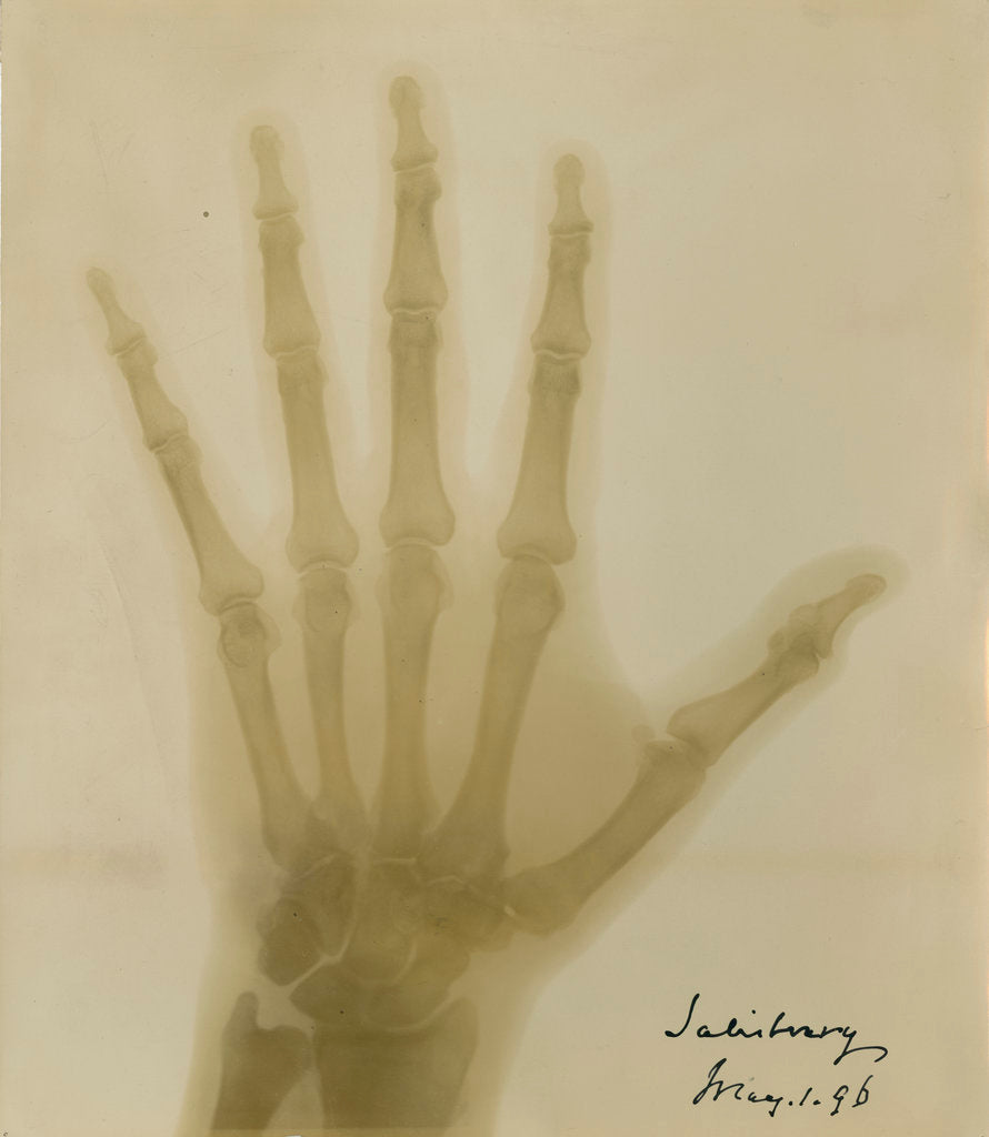 Detail of X-ray photograph of the hand of Robert Arthur Talbot Gascoyne-Cecil by Alan Archibald Campbell Swinton