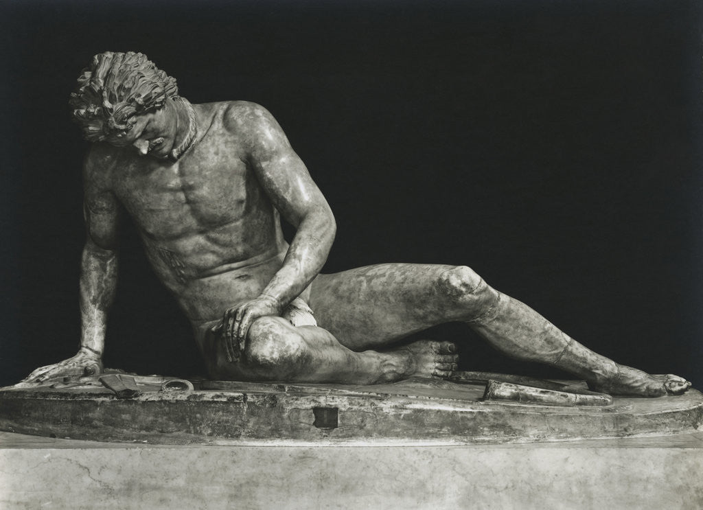 Detail of Sculpture of Man Partially Overcome by Anonymous