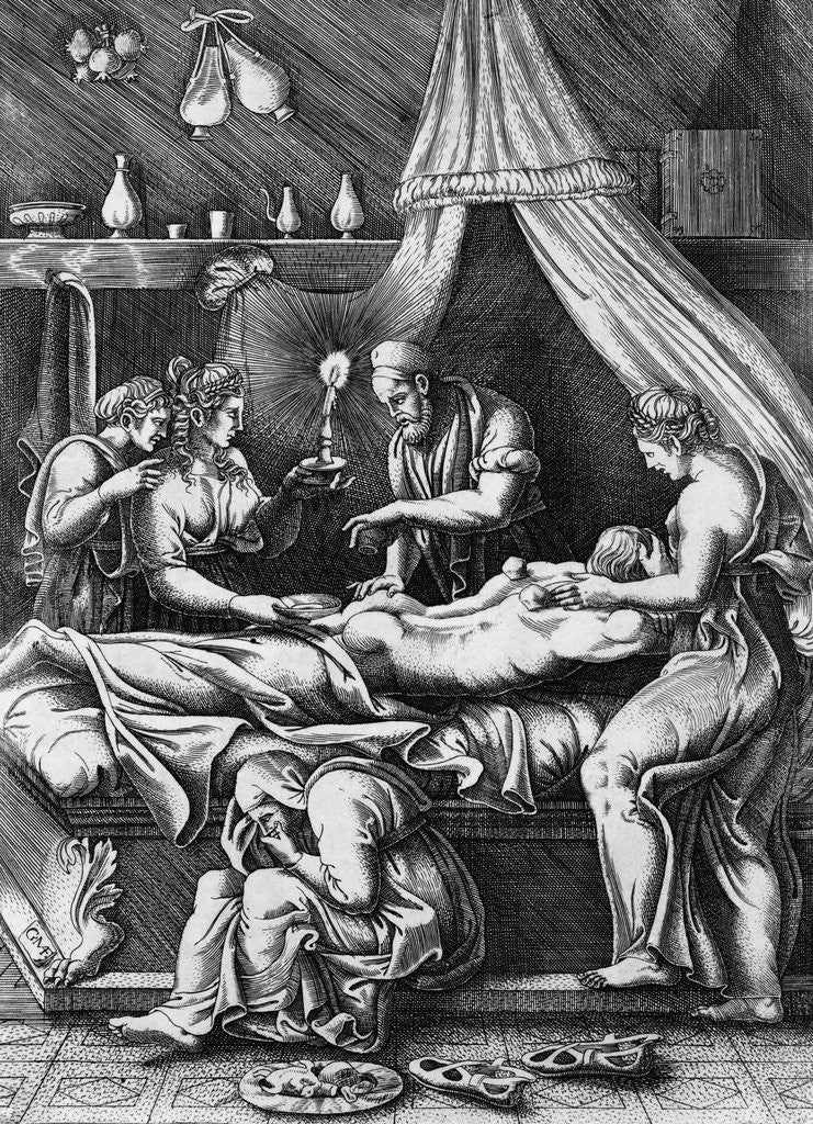 Detail of Illustration of Doctor Cupping Patient by Corbis