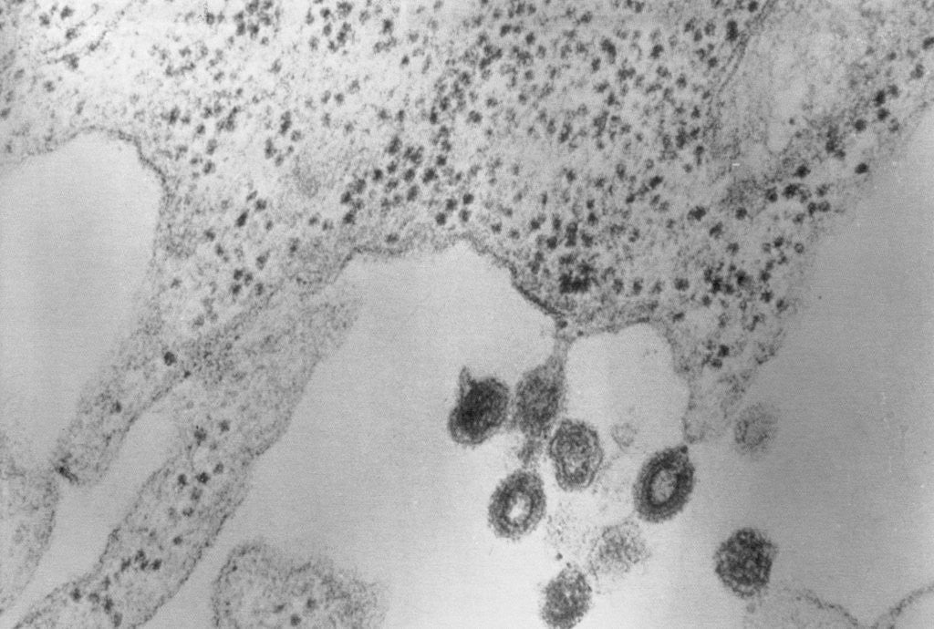 Detail of Tumors Budding from Cell Membrane by Anonymous