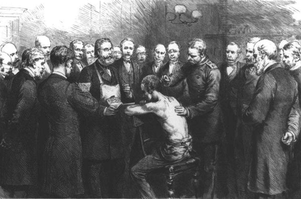 Detail of Dr Koch's Treatment for Consumption at the Royal Hospital, Berlin: Professor Pfuhl Inoculating a Patient with the Lymph by English School